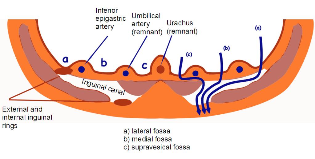 Internal surface of the anterolateral abdominal wall