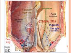 Medial inguinal fossae Medial inguinal fossae between the medial and the lateral umbilical folds, areas also commonly