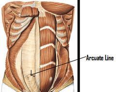 ARCUATE LINE The arcuate line of the abdomen, linea semicircularis