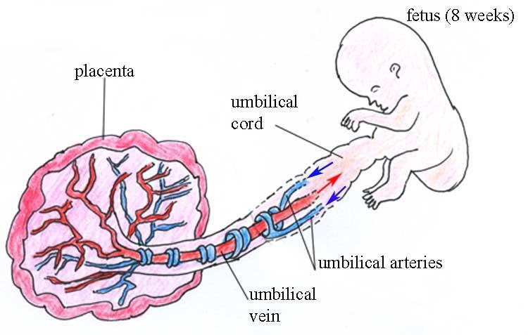 Post natal patency of the umbilical vein The umbilical vein is a vein present during fetal development that carries oxygenated blood from the placenta into the growing fetus.