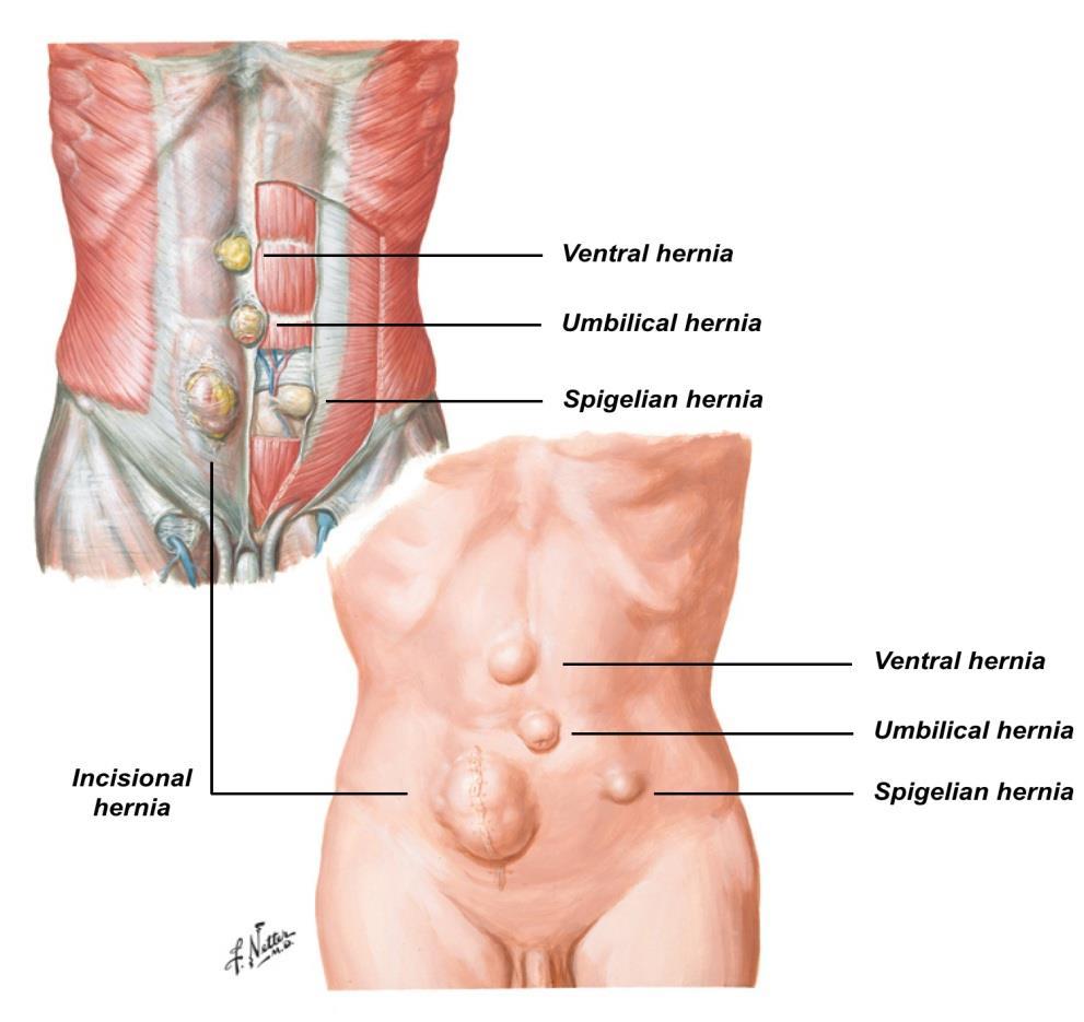 Internal surface of the anterolateral abdominal wall The location of a