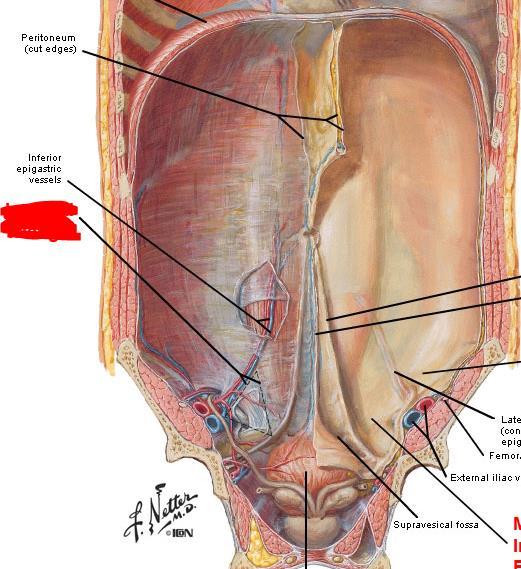 Internal surface of the anterolateral abdominal wall 1. Median Umbilical folds In the midline, there are elevations of peritoneum with free edges, called folds.