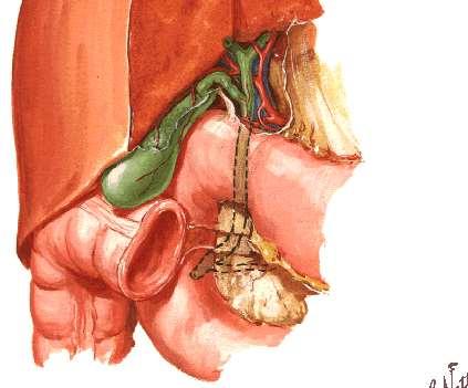 Biliary passages Lt. Hepatic duct Rt.