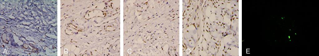 lane 1 and 2. Figure 4. Expression of DDAH2 in penile tissues by immunoenzymatic staining. A: DMED; B: DMED+PBS; C: DMED+null-ADSCs; D: DMED+DDAH2-ADSCs. ADSCs transplanted into penile tissues.