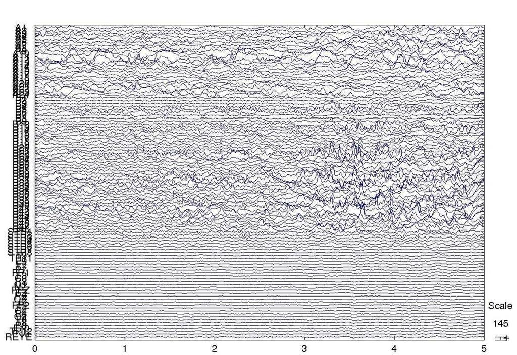 Multiscale Data Time (s) Five seconds of concurrent cortical grid (top) and EEG (bottom)
