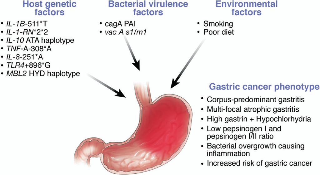 January 2008 H pylori AND HOST-BACTERIAL INTERACTIONS 317 Figure 3. Contribution of host genetic, bacterial, and environmental factors to pathogenesis of H pylori-induced gastric cancer.