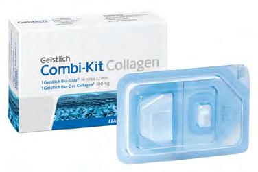 Geistlich Bio-Oss Collagen provide optimal properties for ridge preservation and