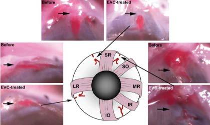 Episcleral vein cauterization rat glaucoma model-surgical procedure Under general anesthesia and aseptic conditions