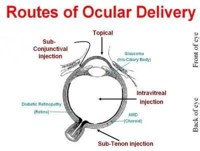 Typical Routes of Administration for Ocular Studies at CBI Topical Intra vitreal