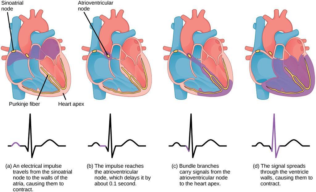 Exercise Physilgy CardiRespiratry Trimester 2 Sinatrial (SA) nde: impulse-generating (pacemaker) tissue lcated in the right atrium f the heart Atriventricular (AV) nde: part f the electrical cntrl