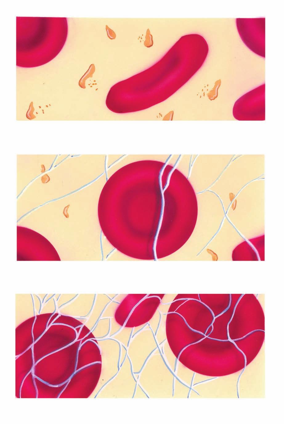 Blood Clotting Platelets rupture, releasing a chemical into the blood.