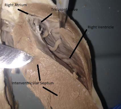 Ben Martin 11-27-15 Above is the right atrium and ventricle.