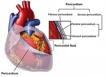 COVERINGS OF THE HEART Pericardium loose fitting sac surrounding the heart made of: Fibrous pericardium Serous pericardium owith parietal and