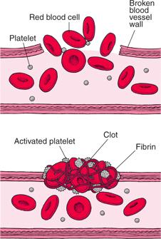 Steps in Clotting 1. Break in capillary wall. 2. Clumping of platelets 3. Clot forms. Animation http://www.