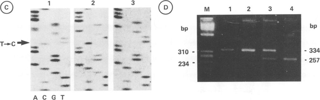 Silent mutations in the phenylalanine hydroxylase gene as an aid to the diagnosis of phenylketonuria AP 346 5 - ggtccccgactccctctgctaacctaacctgcattctgctgtgcccctgecctgct