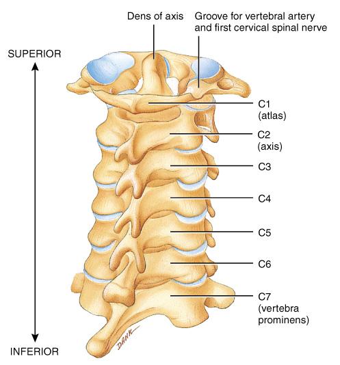 Typical Cervical Vertebra Smaller bodies Larger spinal