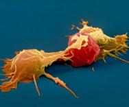 Immune biomarker studies Natural Killer (NK) Cells Phagocytic cells NK