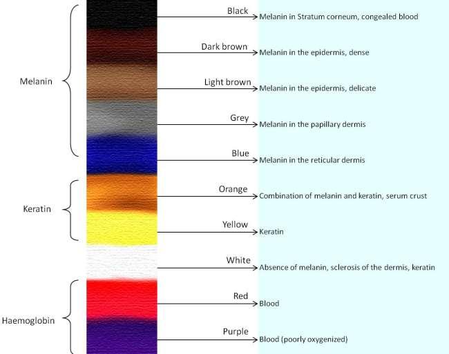 Colour Colour can help identify certain lesions It can also help identify at which level in the skin the lesion sits With regards to melanocytic lesions the more colours / shades of colour, the more
