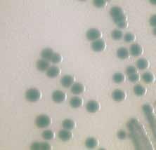 VIBRIO Only Chromogenic media to differentiate Vibrio choloerae, Vibrio parahaemolyticus and