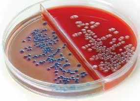If the infecting organism is E. coli, the colonies on the chromogenic side of the biplate will turn blue. 1 The blue color is confirmatory! No further confirmation or indole testing is required.