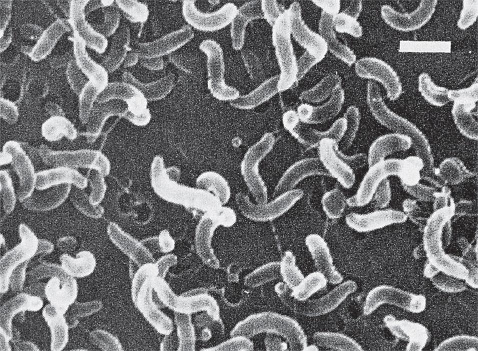 Diseases of the Campylobacter Vibrios Slender, curved, or spiral bacilli, often S-shaped or gull-winged pairs S Comma Polar flagella Spiral Common residents of the intestinal tract, genitourinary