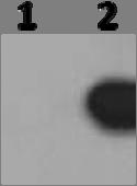 A.2.3b. An example of an Akt Total x-ray film from Chapter IV. This is an x-ray of the same membrane that is shown in A.2.1b. after it has been stripped an re-probed with Akt Total primary antibody.