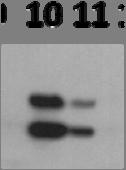 primary antibody was a rabbit polyclonal antibody that recognized P-S6K1 Thr 389, which is present in two forms