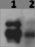 A.2.4b. An example of a P-S6K1 Thr 389 x-ray film from Chapter IV. This is an example of a horse on NSAID treatment.