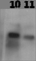 primary antibody was a rabbit polyclonal antibody that recognized S6K1 Total, which is present in two forms the 85