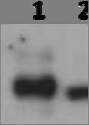 A.2.5b. An example of an S6K1 Total x-ray film from Chapter IV. This is an x-ray of the same membrane that is shown in A.2.4b. after it has been stripped an re-probed with S6K1 Total primary antibody.