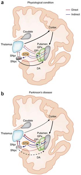 Figure 2: Schematic representation of the direct/indirect pathway classical model in the physiological condition and in Parkinson s disease.