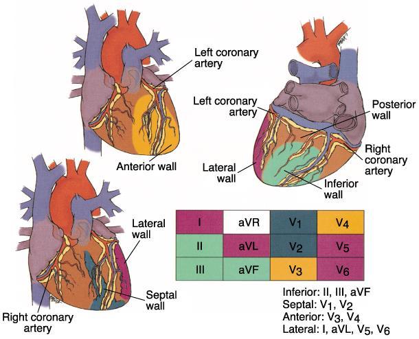 Localization of Infarct From