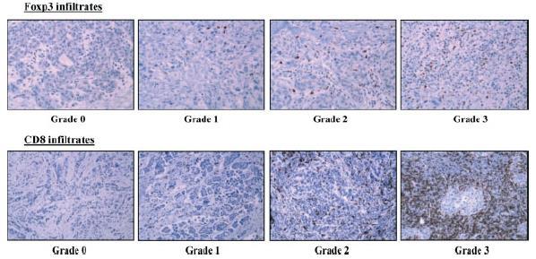 HER2+ BC : CD8/FOXP3 post treatment Ladoire S et al, J Pathol 2011 (PMID 21437909) - 111 HER2+ BC treated by a NACT ; residual tumors - analysis of tumor-infiltrating lymphocyte subpopulations by