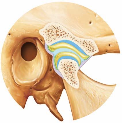 External acoustic meatus Mandibular fossa tubercle Zygomatic process Infratemporal fossa Mandibular fossa disc tubercle Superior joint cavity Ramus of mandible Synovial membranes Condylar process of