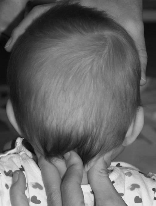The other hand is placed on the head. 3. The child s head is gently placed in relative flexion until the cervical spine is in a postural neutral position. 4.
