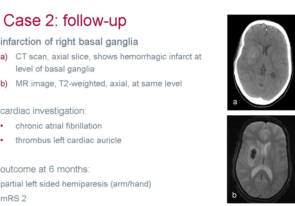 Fig. 7: Case 2: imaging and