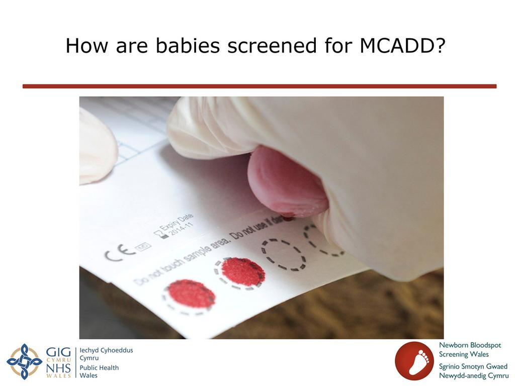 Slide 7: How are babies screened for MCADD? Newborn bloodspot screening for MCADD started in Wales in June 2012.