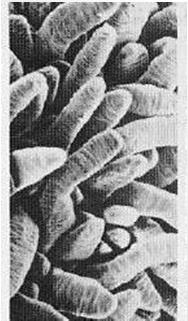 , 1998 Villus scan of jejunum