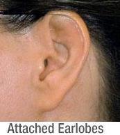 Ear lobes Detached ear lobe E _ Attached