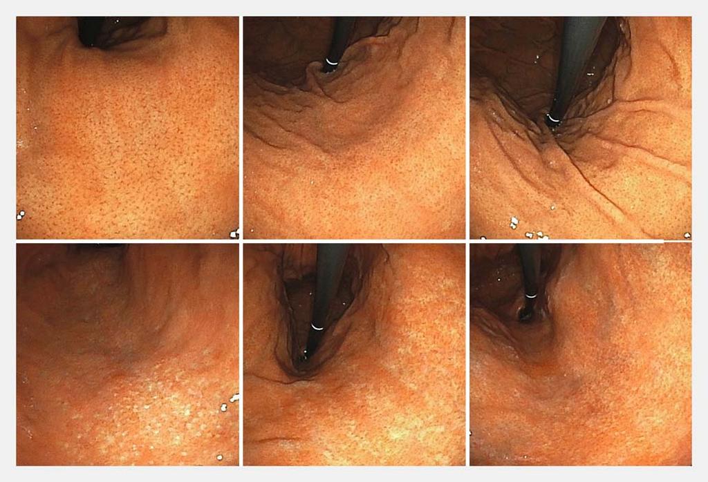 Fig.1 Examples of endoscopic images obtained from individuals who, upon laboratory