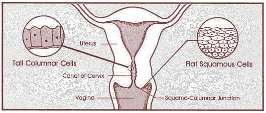 Transformation zone Cervix develops from 2 embryonic sites * from Mullerian duct - lined by columnar epithelium * from urogenital plate -
