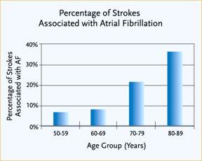 the risk of stroke