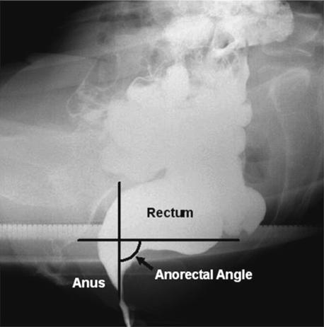 30 V.C. Costilla and A.E. Foxx-Orenstein Fig. 2.4 Anorectal angle.