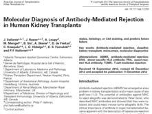 Sellares et al AJT 12: 388, 2012 Progress is slow 1990: Recognition of ABMR as a microcirculation process distinct from TCMR, an
