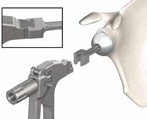 Attach sleeve (E) to top lever (F) with a