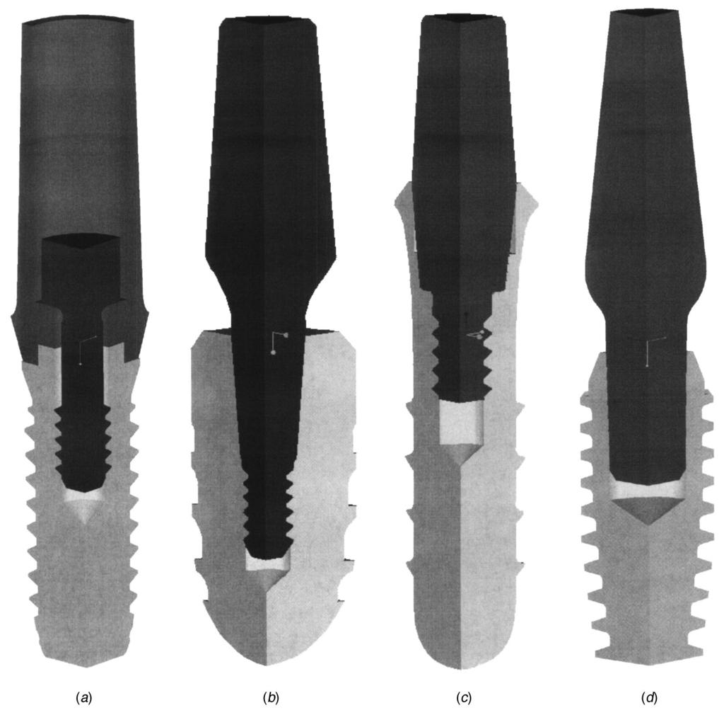 Fg. 1 Varous mplant-abutment attachment methods are used n commercally avalable dental mplants. a screw only; b and c TIS; d TIF type attachment methods burg, Swtzerland, shown n Fgs.