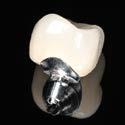 Having received the BellaTek abutment and the SLA model, your