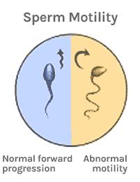 IN DETAIL: MOTILITY Motility: amount of sperm that are swimming, or moving normal >40% Progressive motility: amount of sperm that are moving forward