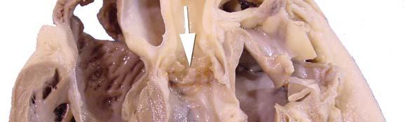 Thoracic Cavity: Note the