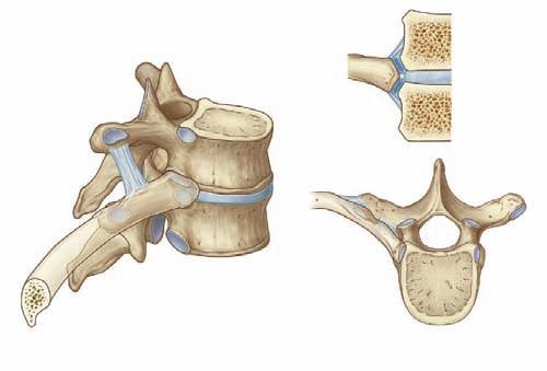 Regional anatomy Thoracic wall 3 Joints Costovertebral joints A typical rib articulates with: the bodies of adjacent vertebrae, forming a joint with the head of the rib; and the transverse process of